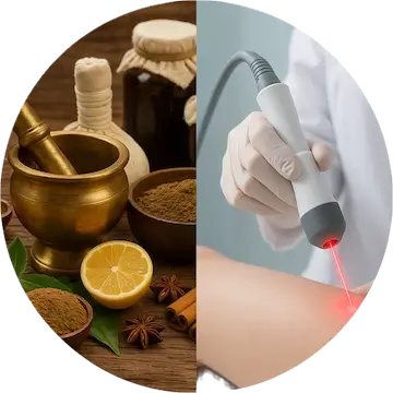 Laser Piles treatment